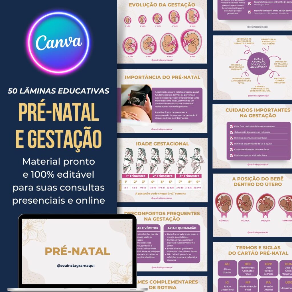 Doula Continente Animação Legítimo Autorizado Platinum Edition